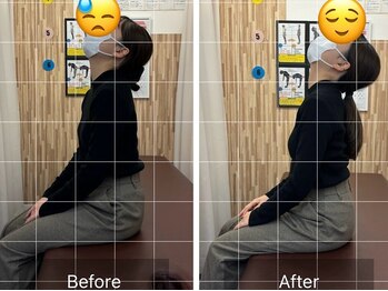 ナオル整体 札幌院(NAORU整体)/札幌円山/整体/姿勢矯正/猫背