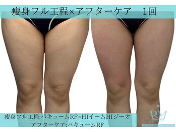リメイククリニカルビューティー(Remake clinical beauty)/足の隙間つくりませんか?