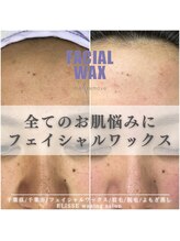 エリス(ELISSE)/お肌改善の近道