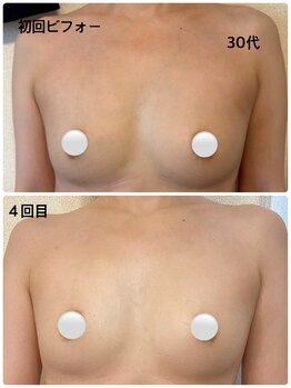 ハク 阪急茨木(HAKU)/ビフォーアフター