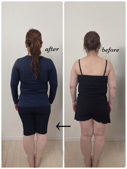 クロス(Cross)/骨格矯正(美容整体)3回