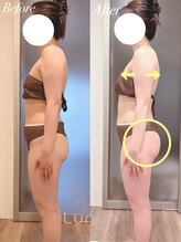 ルノン(Lunon)/【ブライダル】ダイエット1回目