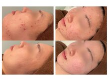 ビオエル 横浜店(Bioel)の雰囲気（クリスティーナ4種類☆ハーブピーリング3種類！）