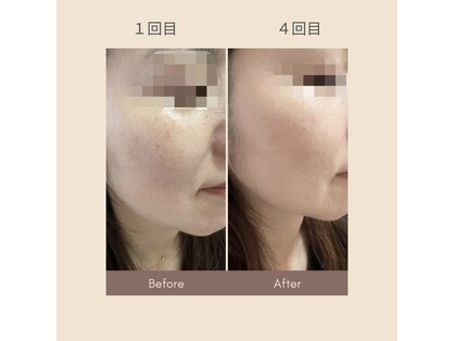 ノアレ(NoaRe)の写真