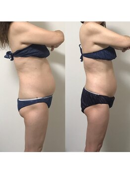 エステサロンクオーツ/オールハンド100分