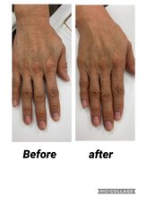 美バリ 新宿店(美BARI)/ハンド　エアバリでハンドケア！