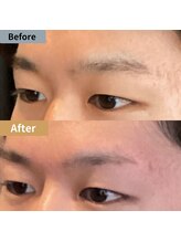 眉毛ハウス 吉祥寺店(眉毛HOUSE)/お客様の施術例(吉祥寺/東京)