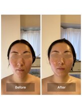 パピヨン(papillon)/ビフォーアフター