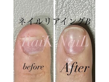 ライクネイル 本店(RaiK NaiL)