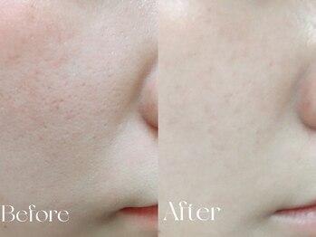 ウィハナ(wehana)/【ララピール×セラピール】