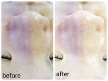 黒ずみ・くすみ肌・赤み肌にもおすすめ☆