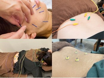 かわ鍼灸整体サロンの写真/【当店人気No1★】全身オーダーメイド鍼灸+整体コース!慢性的/どこへいっても改善されない悩みの根本改善へ