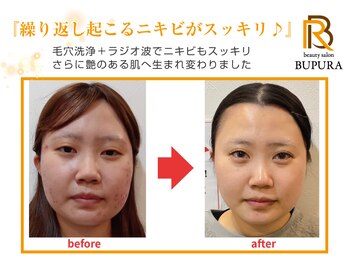 ブプラ つくば店(BUPURA)/before→after　３
