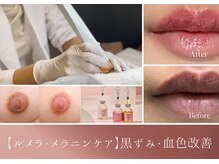 ウェルビー(Well-Be)の雰囲気（話題のルメラで圧倒的トーンアップ★デリケートな黒ずみにも◎）