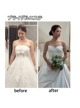 エステティックレイビス 名古屋店(RAYVIS)/ブライダルエステ♪