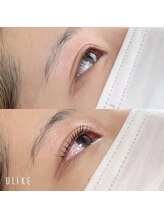 プローサム(Prorsum)/瞳に光を♪