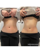 ルナート(Lunart)/【腸もみ】でぽっこり解消