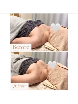 ハニー(Honey)/before★after