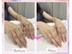 ぱとらの手の秘密の写真