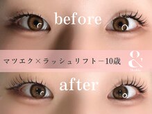 ミヨン(Miyon)/アンドヘルシー　120本