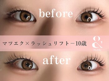 ミヨン(Miyon)/アンドヘルシー　120本