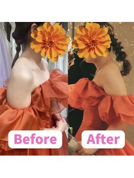 ボディキュア ブライダル美容整体 大阪梅田/【巻き肩】華奢な身体に/関西