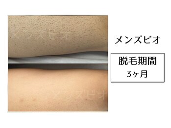 メンズビオ 神戸三宮店/