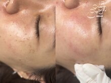 サゥオルサロン(sawalsalon)