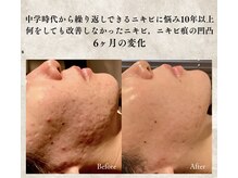 アミュレット(AMULET)の雰囲気（県内初！【プラソニック】プラズマでお肌の凸凹も改善）