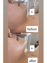 ベルファム(Belle femme)/頭蓋骨小顔矯正オールハンド技術