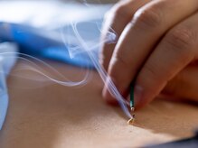 スクナビコナ鍼灸院