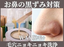 マヴィ 藤井寺店(MavY.)/黒ずみには、、、