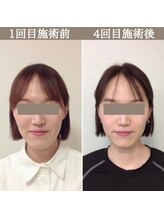 シェア 人形町店(Chare)/【小顔・骨盤矯正・О脚・整体】