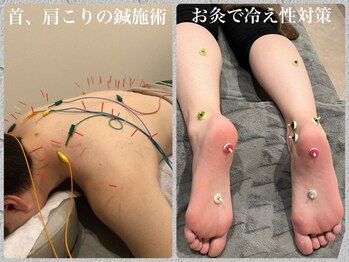 ネクサス(NEXUS)の写真/【鍼灸×整体】首肩の蓄積した疲労や不調を改善◇美容鍼では小顔効果お肌の悩み解消で美と健康をサポート◎