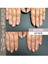 亀裂改善、自爪育成、ネイルケア