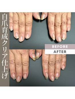 亀裂改善、自爪育成、ネイルケア