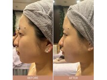 ビーエヌ エステティックアンドスパ(BN Esthetic&Spa)/浮腫み改善コルギ