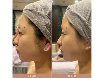 ビーエヌ エステティックアンドスパ(BN Esthetic&Spa)/浮腫み改善コルギ