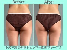 ビーナイス ビューティー(Be Nice Beauty)/夏の旅行が今から楽しみ♪