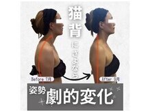 小顔フェイスラボ 袋井店(小顔FaceLabo.)の雰囲気（整体コルギで肩こり&首コリ解消しながら、猫背・巻き肩も改善◎）