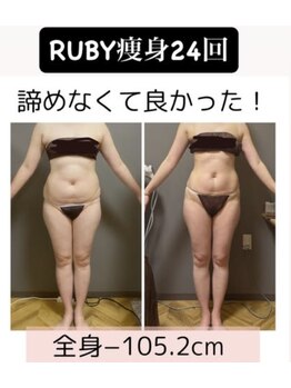 ルビー(RUBY)/セル脂肪に集中アプローチ