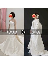 グレフル鍼灸接骨院 整体院 心斎橋/ブライダル/肩甲骨はがし/美鎖骨