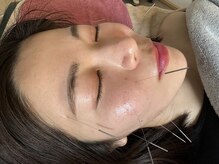 ナノフェイス 名古屋駅前店(nano face)