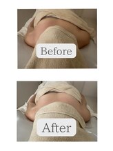 オン 絹(on silk)/フェイシャル80分1回