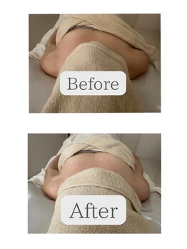 オン 絹(on silk)/フェイシャル80分1回