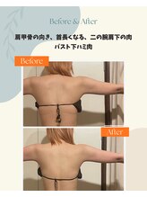ヨサパーク サンテ 祐天寺(YOSA PARK sante)/痩身/ダイエット/よもぎ蒸し痩身