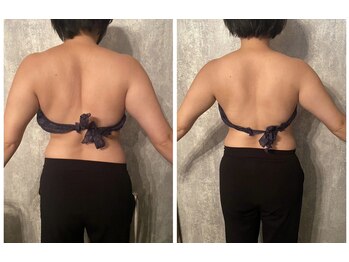 エノアシュエット(Enoachouette)の写真/悩める二の腕にサヨナラ♪二の腕の脂肪を狙い撃ち!