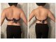 エノアシュエット(Enoachouette)の写真/悩める二の腕にサヨナラ♪二の腕の脂肪を狙い撃ち!