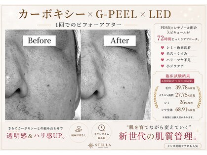 ステラ(STELLA)の写真