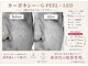 ステラ(STELLA)の写真